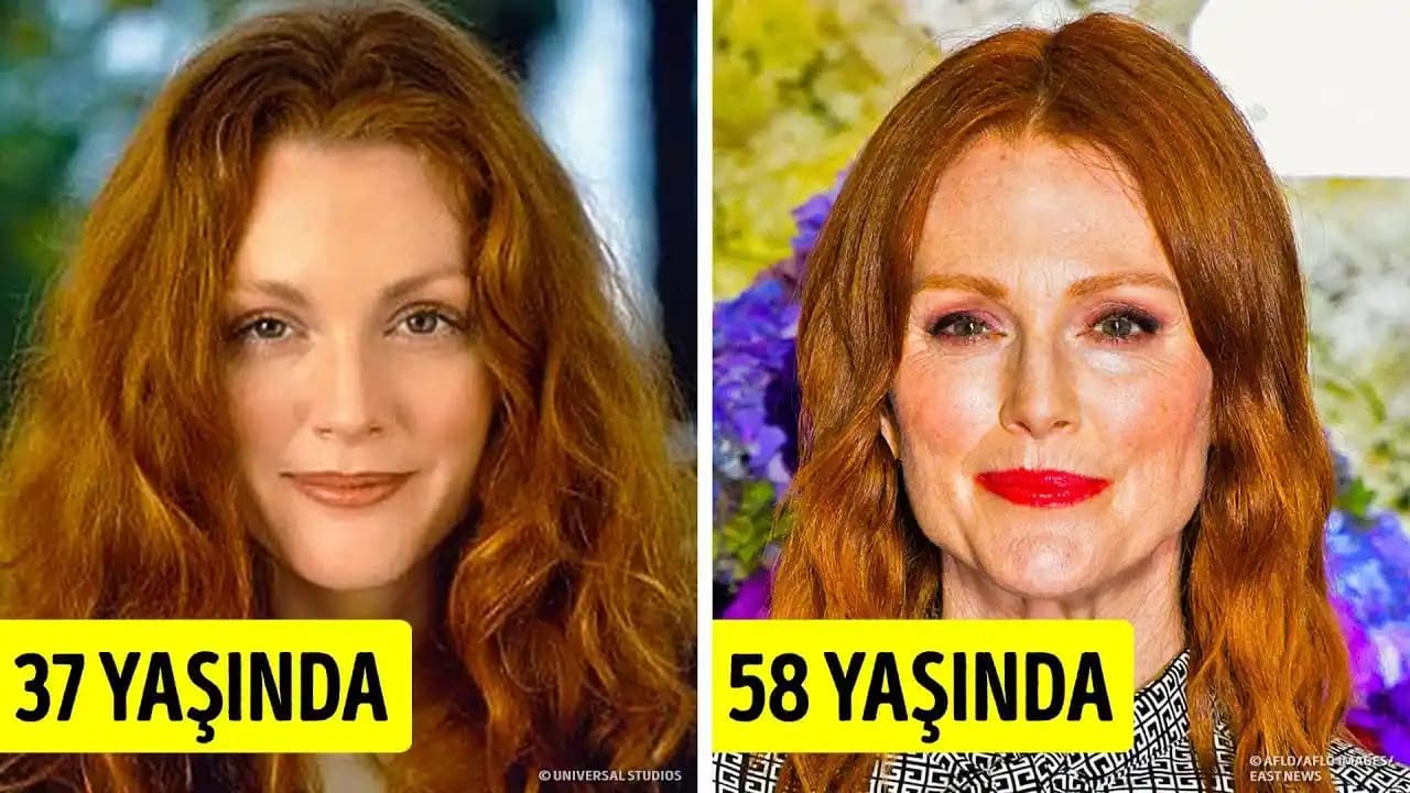 Amerikan Aktörlerinde Estetik Cerrahi ve Doğal Görünüm: Yaşlanma ve Algılar Üzerine Analiz