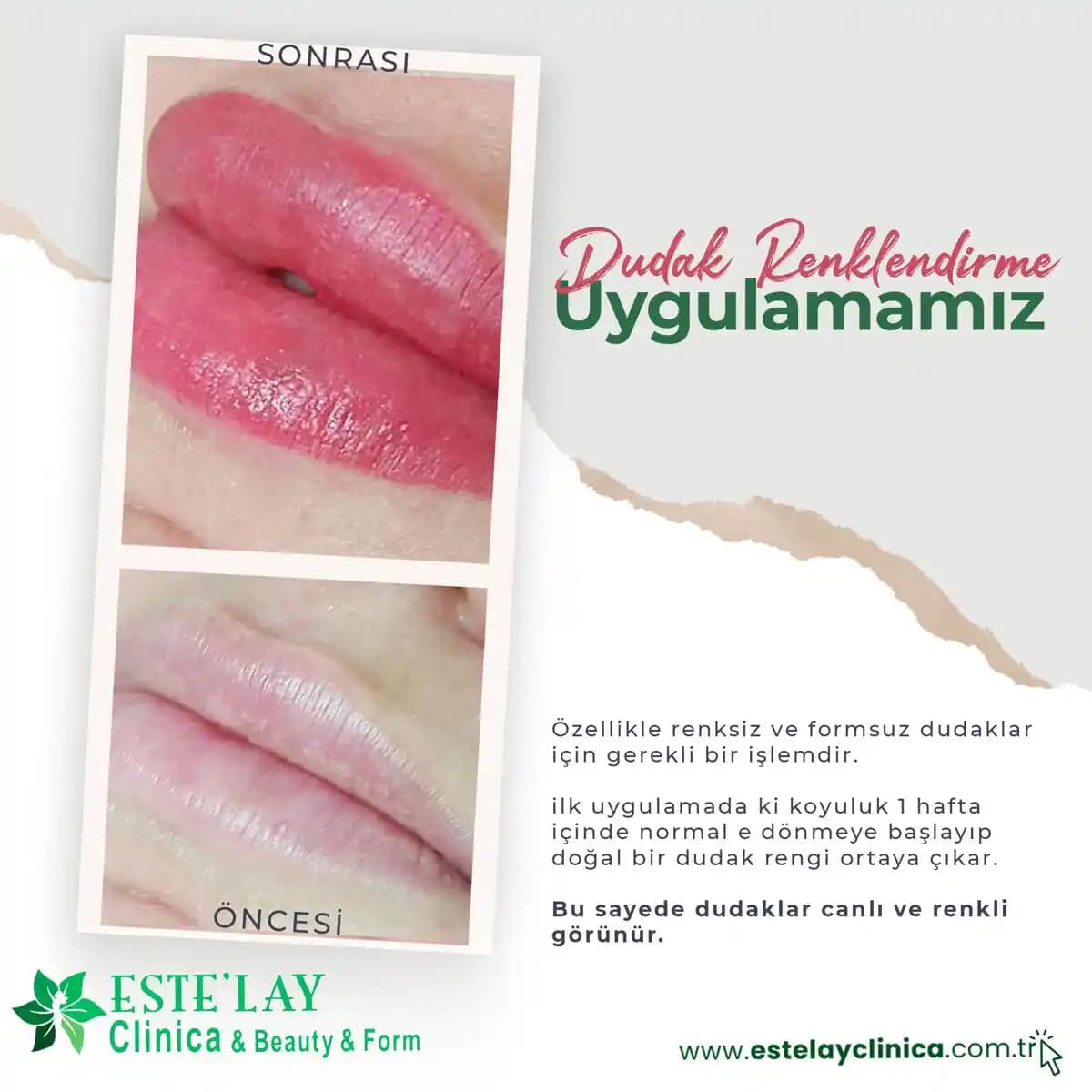 Üst Dudak Tüylerinden Kurtulma Yöntemleri ve Cilt Bakımı Rehberi