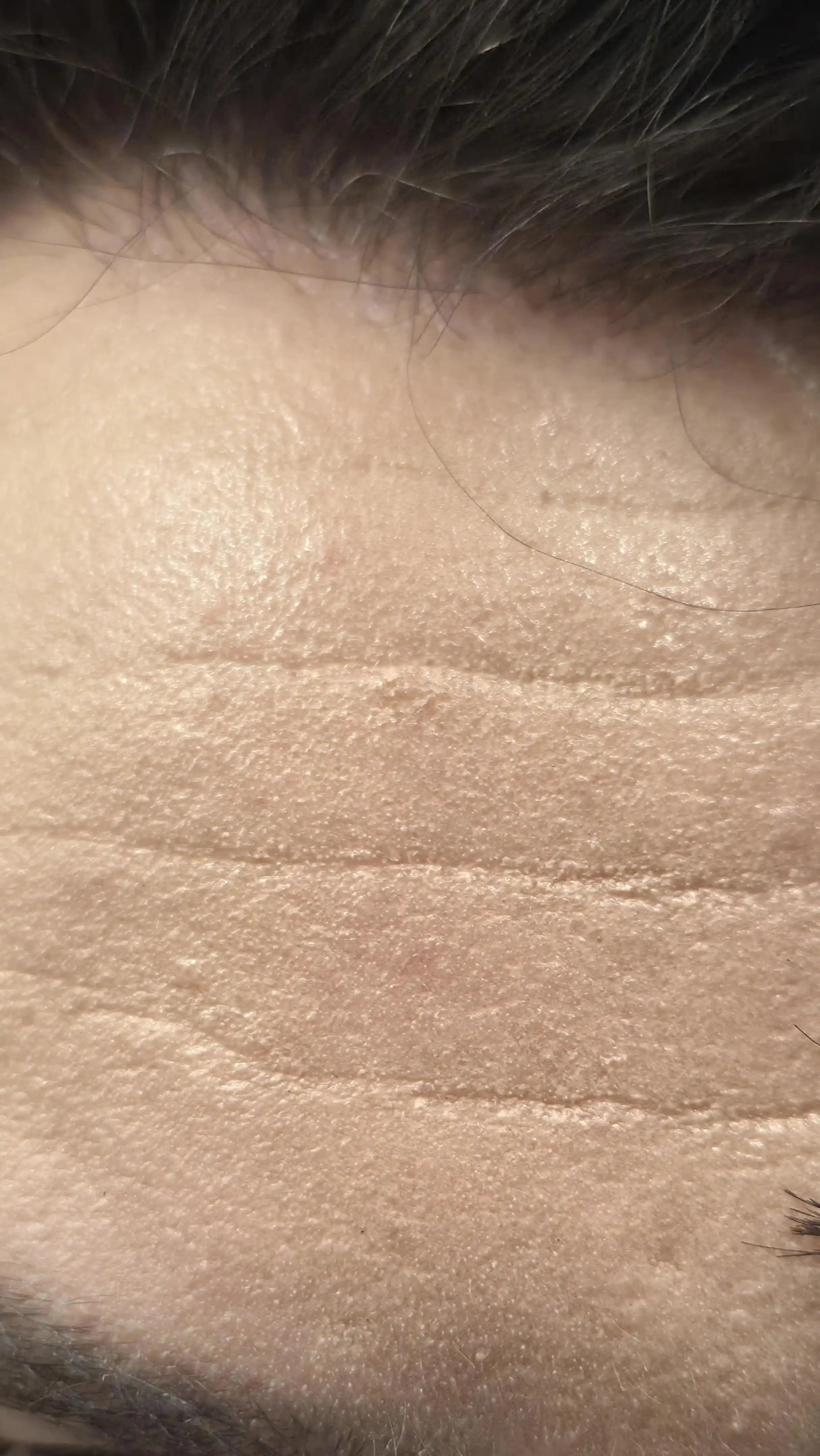 Yağlı Ciltler İçin Renkli Güneş Kremlerinde Kimyasal ve Mineral Filtrelerin Etkisi