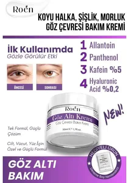 Roen Göz Altı Bakım Kremi: Morluklar ve Şişlikler İçin Etkili Çözüm