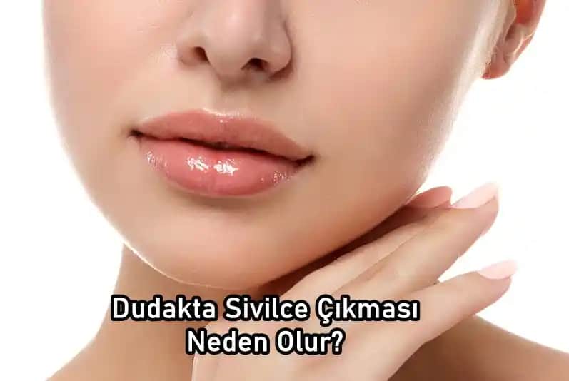 22 Yaşında Sivilce Çıkmasının Nedenleri ve Etkili Çözüm Yolları