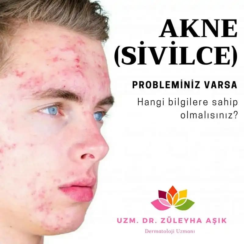 5 Yaşta Sivilce Nedenleri ve Çocuklarda Cilt Bakımı Yöntemleri