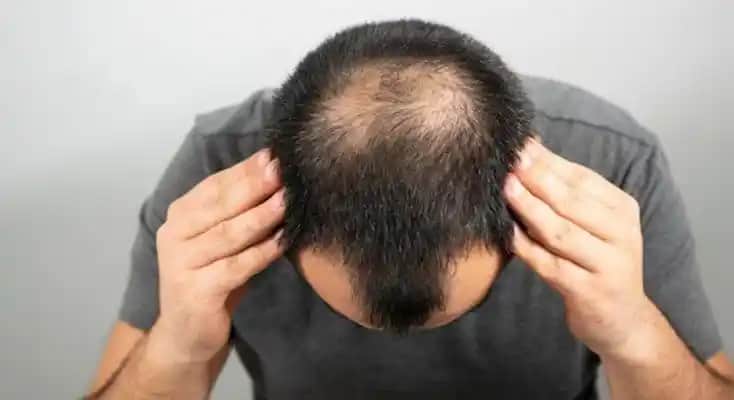 Adana'da Saç Ekimi Fiyatları ve Hizmet Kalitesi Hakkında Bilmeniz Gerekenler