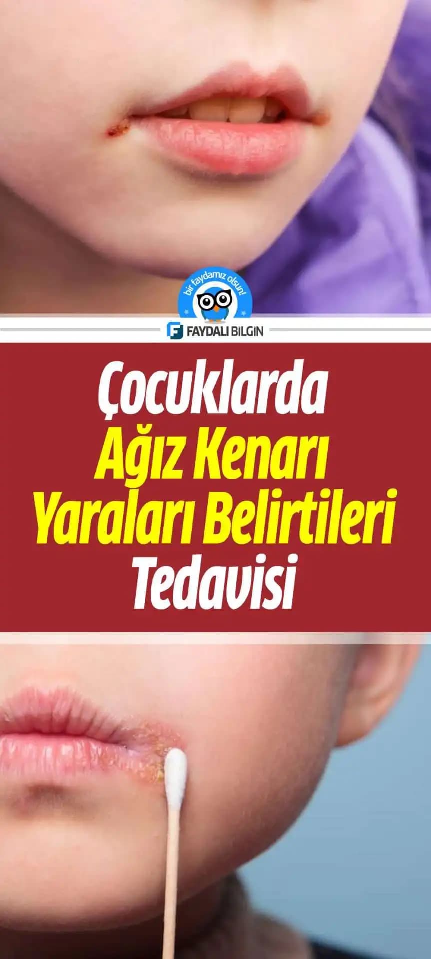 Ağız Kenarı Kararmaları Nedenleri ve Doğal ile Profesyonel Çözüm Yöntemleri