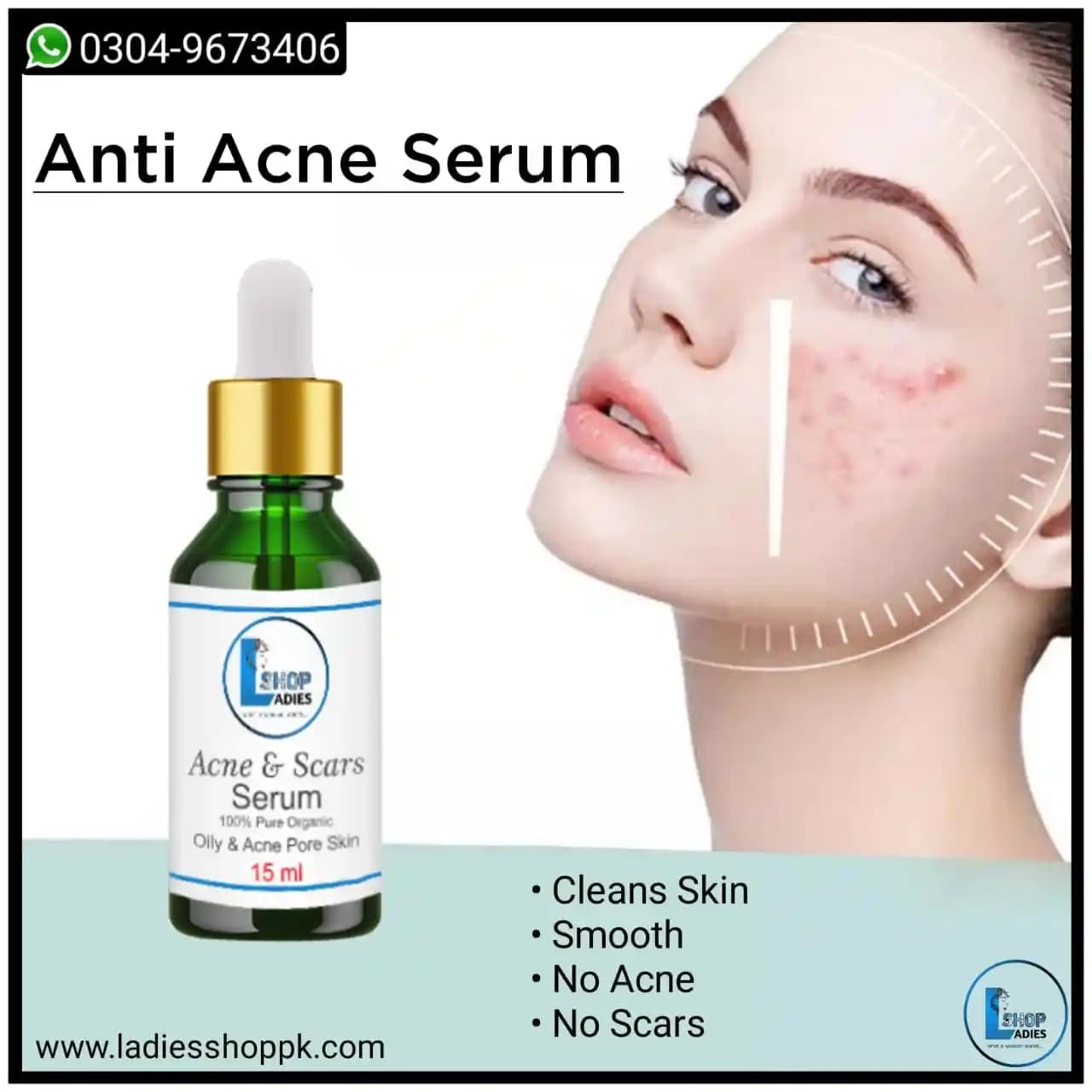 Akne Serumu Nedir, Nasıl Seçilir ve Doğru Kullanım İpuçlarıyla Cilt Sağlığını Destekleyin