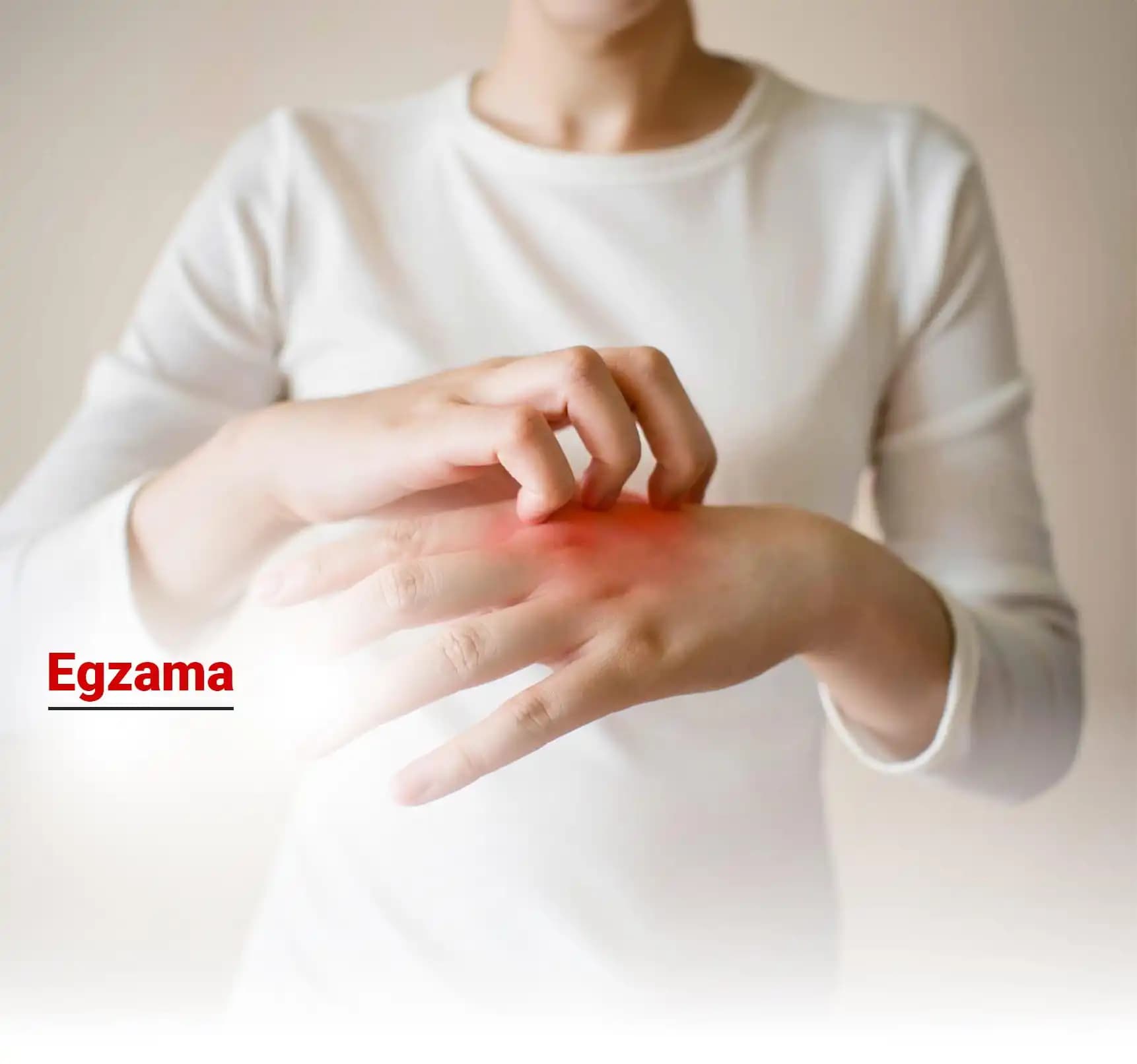 Ateşli Egzama Nedir, Belirtileri ve Kozmetik Ürünlerle İlişkisi Hakkında Bilgiler