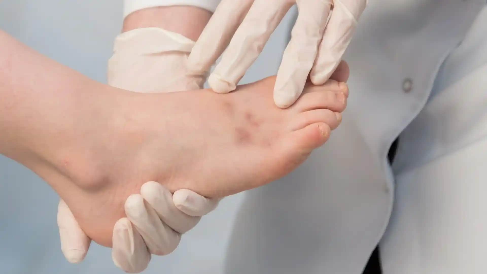 Ayak Altı Turunculuğu Nedenleri ve Sağlık ile Kozmetik Etkileri