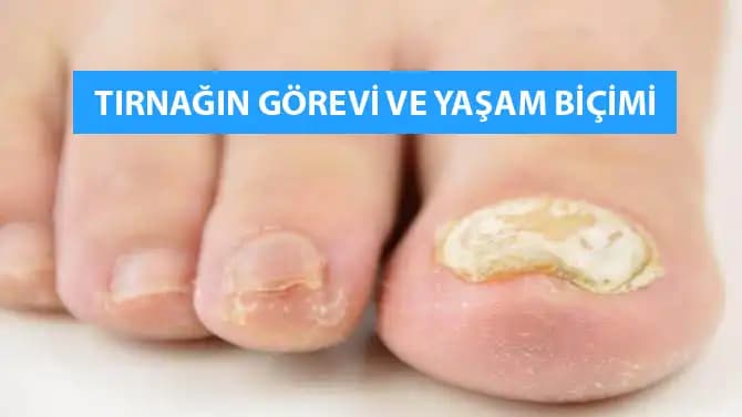 Ayak Tırnağı Kırılması: Nedenleri, Belirtileri ve Korunma Yöntemleri Hakkında Detaylı Bilgi