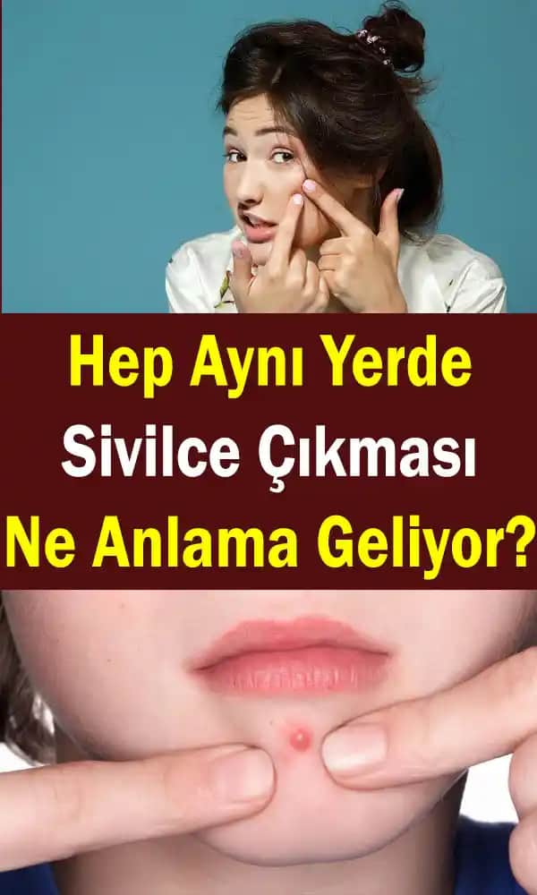 Aynı Bölgedeki Sivilcelerin Nedenleri ve Etkili Çözüm Yöntemleri