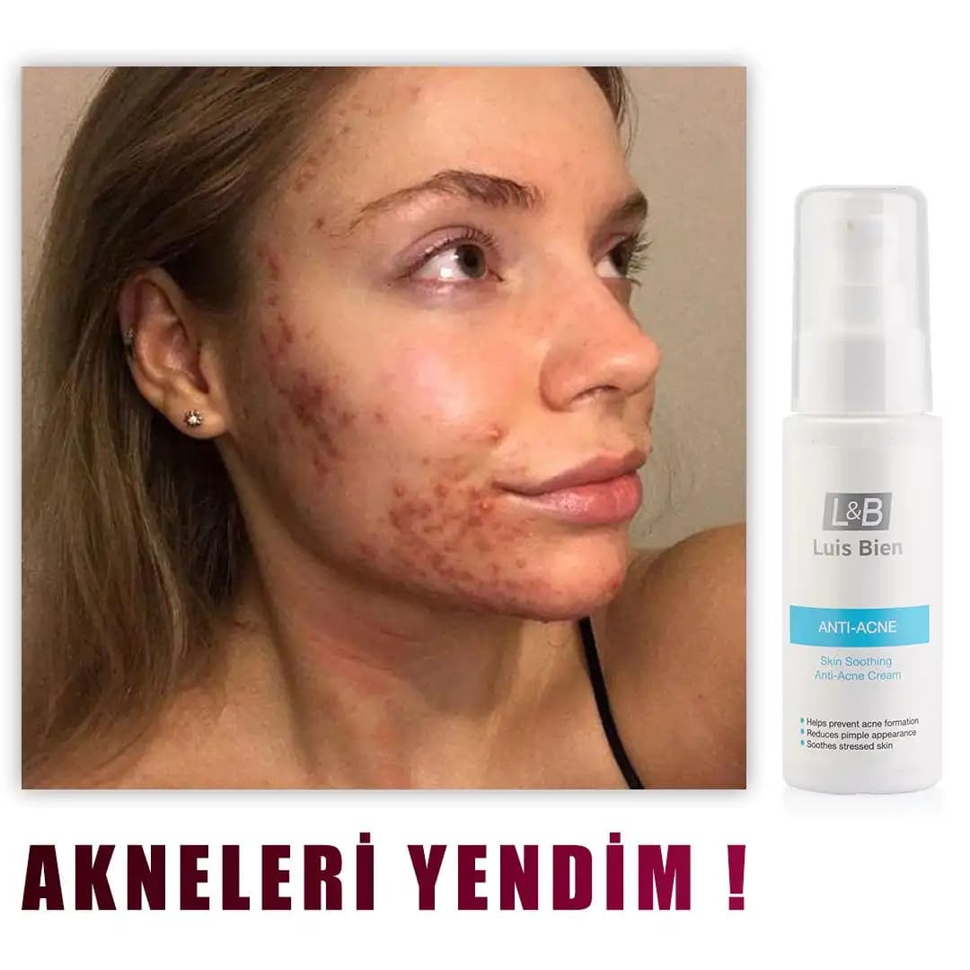 B3 Vitamini İçeren Kremler: Cilt Sağlığını Destekleyen Doğal Bakım Ürünü Rehberi
