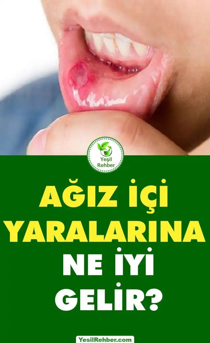 Bacak Yaralarına İyi Gelen Doğal ve Kozmetik Yöntemler Cilt Sağlığını Destekler