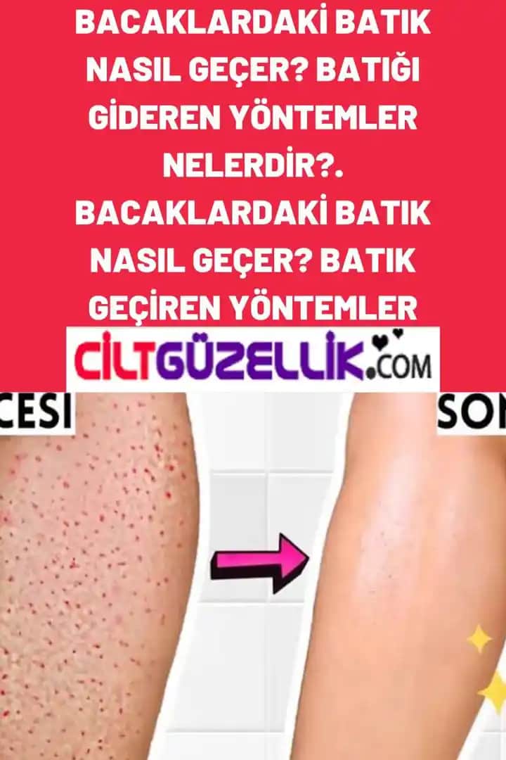 Bacaklardaki Portakal Görünümünü Azaltmak İçin Etkili Kozmetik ve Doğal Çözümler