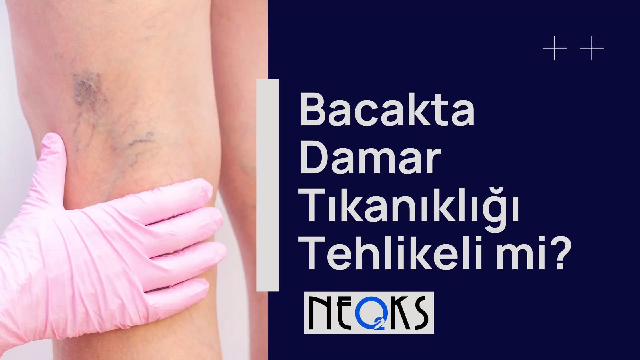 Bacakta Kararma Nedenleri ve Önlenme Yolları Cilt Sağlığı İçin Bilinmesi Gerekenler