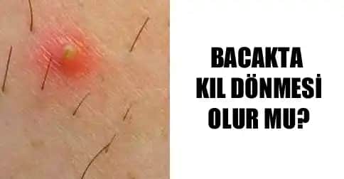 Bacakta Kıl Batması Nedenleri, Riskleri ve Etkili Çözüm Yolları Hakkında Detaylı Bilgi