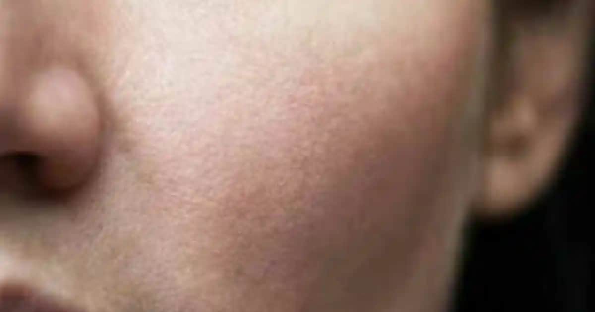 Bazlar ve Cilt Tahrişi: Güvenli ve Sağlıklı Makyaj İçin Bilmeniz Gerekenler