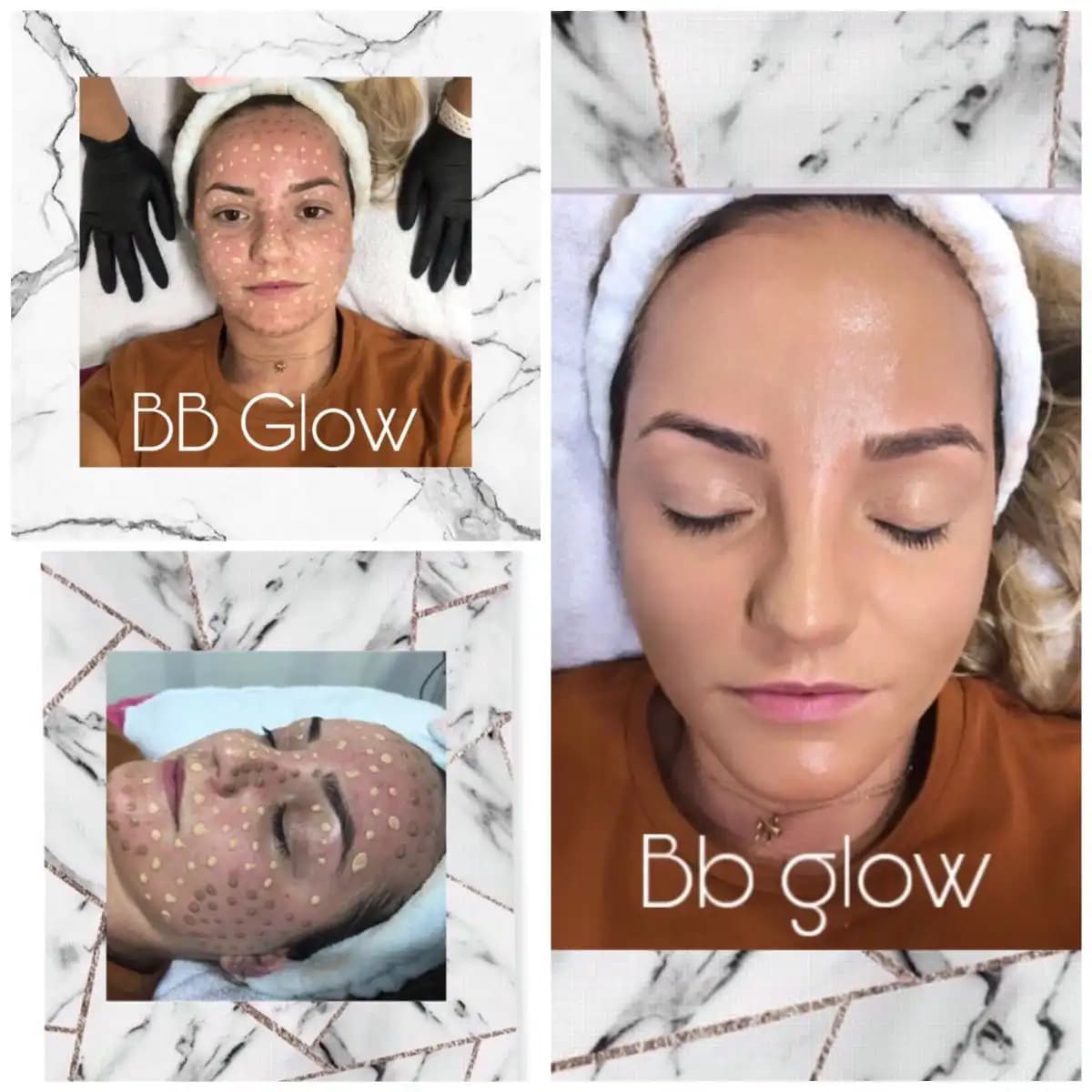 BB Glow Sonrası Bakım Rehberi: Parlak ve Sağlıklı Cilt İçin En İyi İpuçları ve Uyarılar