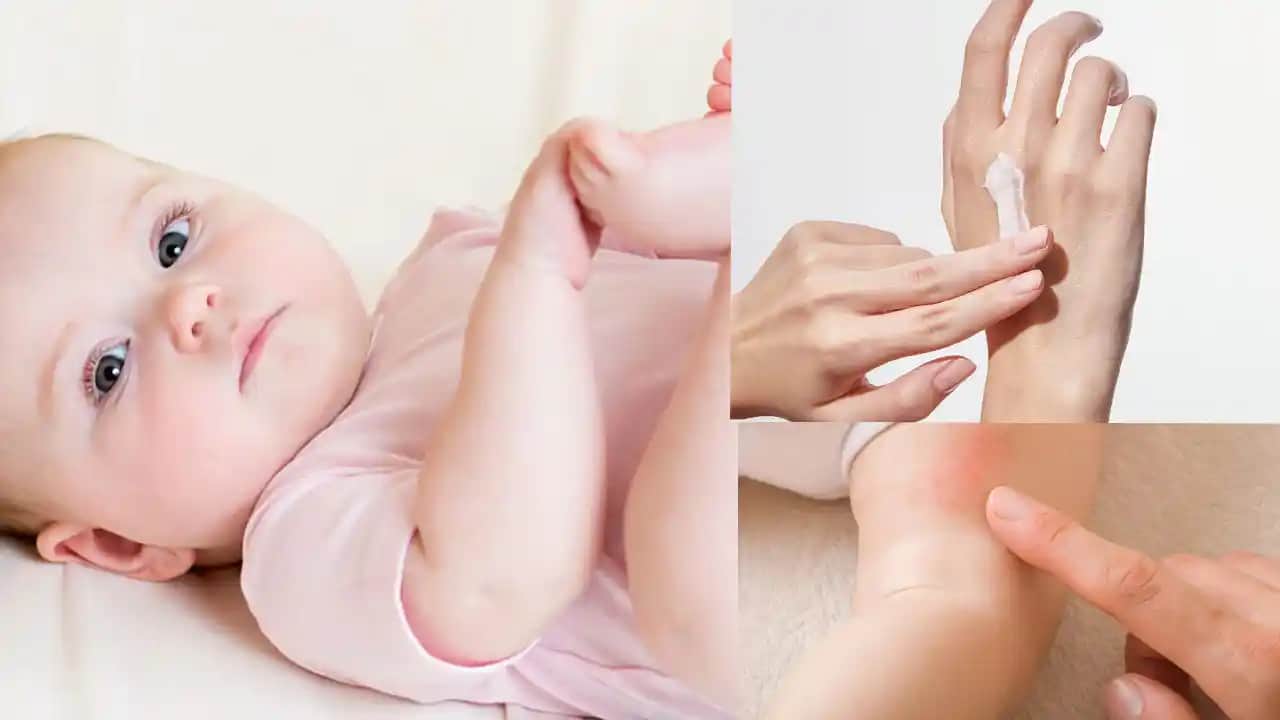 Bebeklerde Pişik Mantarına Karşı Kapsamlı Rehber ve Korunma Yöntemleri