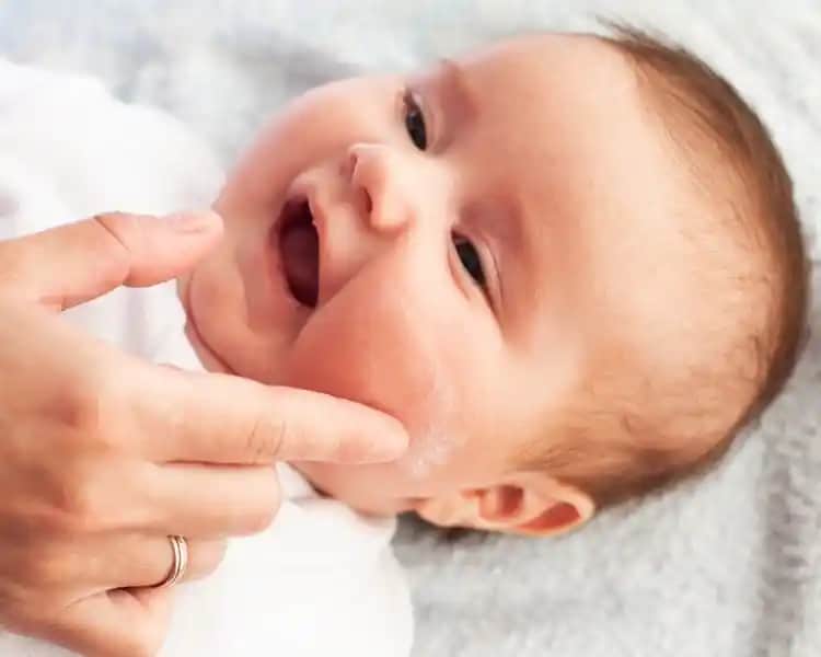 Bebeklerde Saç Egzaması Nedir ve Etkili Tedavi Yöntemleri Nelerdir