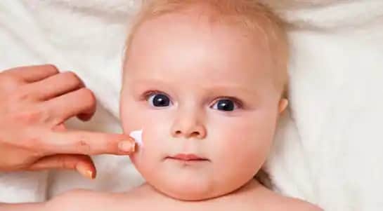 Bebeklerde Sedef Hastalığı Belirtileri ve Cilt Bakımı İpuçları