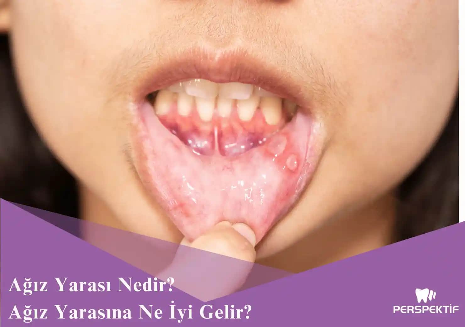 Bıçak Yaralarına Doğal ve Güvenli Yöntemlerle Hızlı İyileşme Rehberi