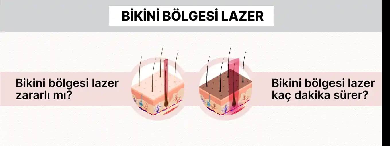 Bikini Bölgesinde Siyah Nokta Sorunu ve Etkili Çözüm Yöntemleri Hakkında Kapsamlı Bilgi