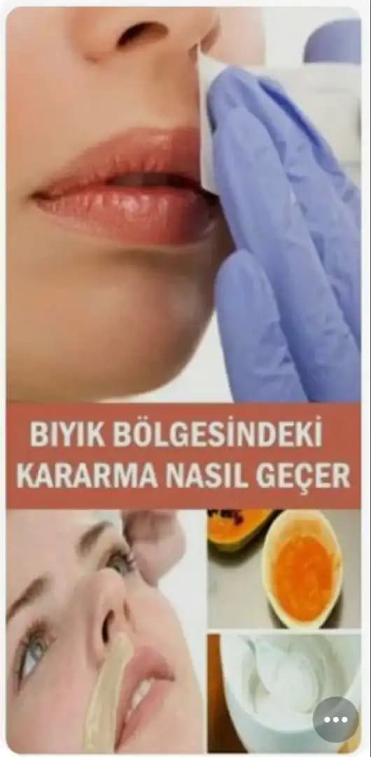Bıyık Üstü Kararma Sorunu ve Çözüm Yolları Hakkında Kapsamlı Rehber