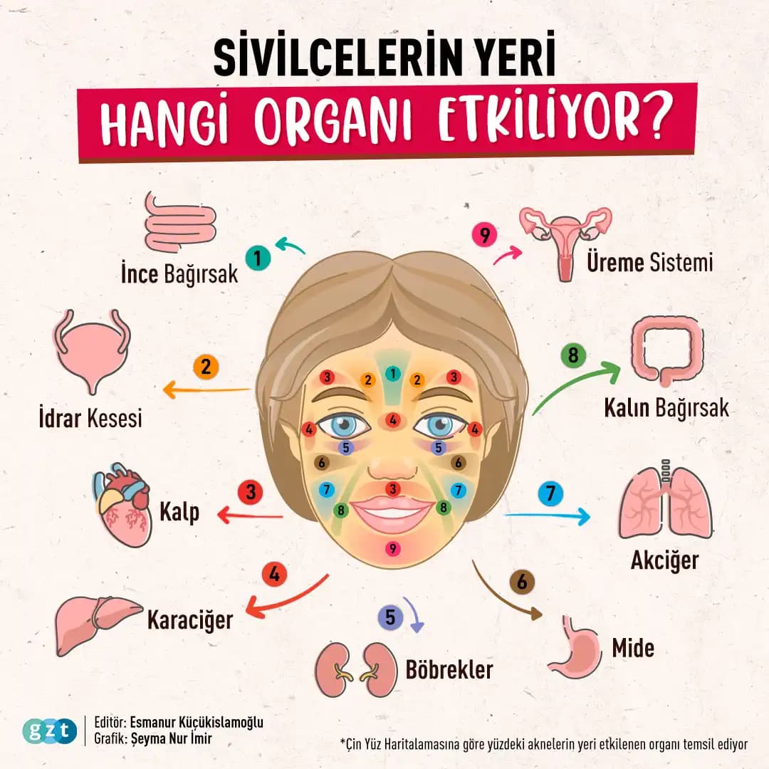 Bölgelere Göre Sivilce Türleri ve Uygun Tedavi Yöntemleri