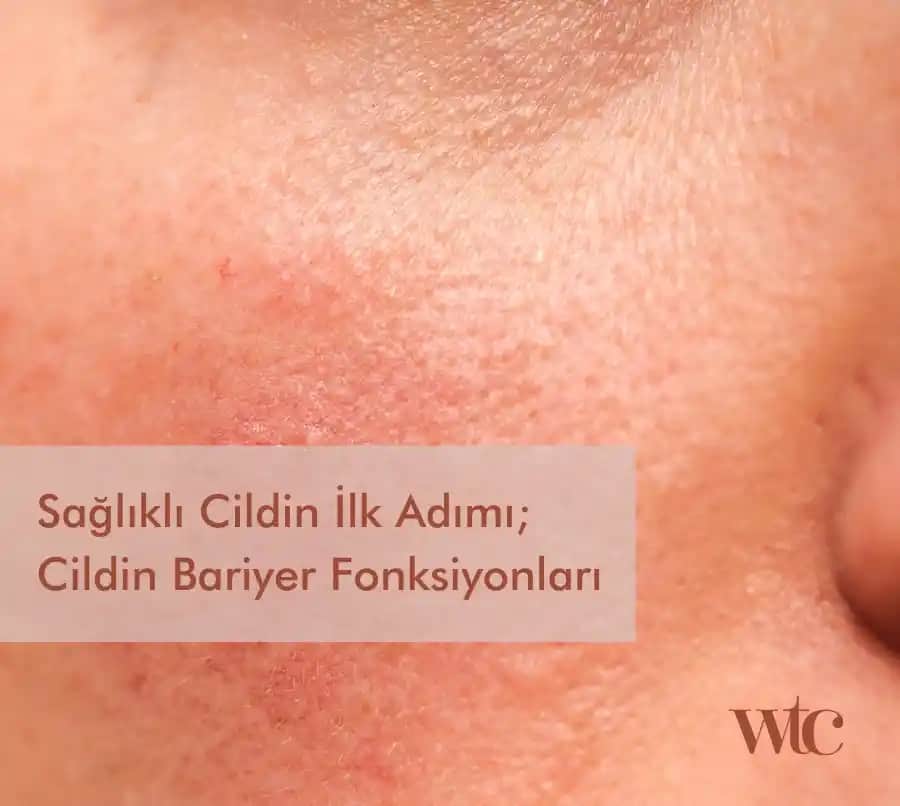 Bozuk Cilt Bariyeri Nedenleri ve Doğru Bakım Yöntemleri