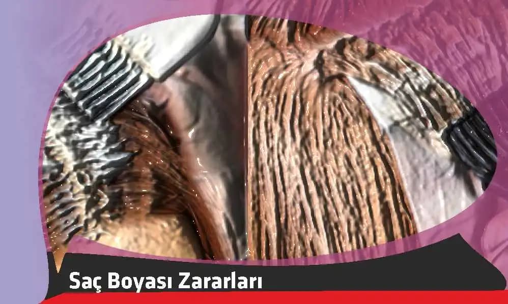 Bozuk Saç Boyasının Zararları ve Güvenli Alternatifler Hakkında Bilmeniz Gerekenler