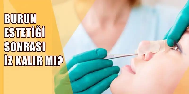 Burun Estetiği Sonrası Dikiş İzleri İçin Krem Kullanımı ve Bakım Yöntemleri