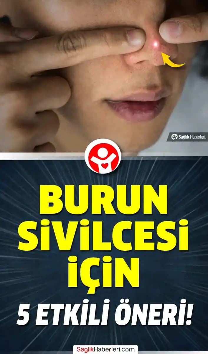 Burun Sivilcesinin Nedenleri ve Etkili Çözüm Yolları Hakkında Detaylı Bilgi