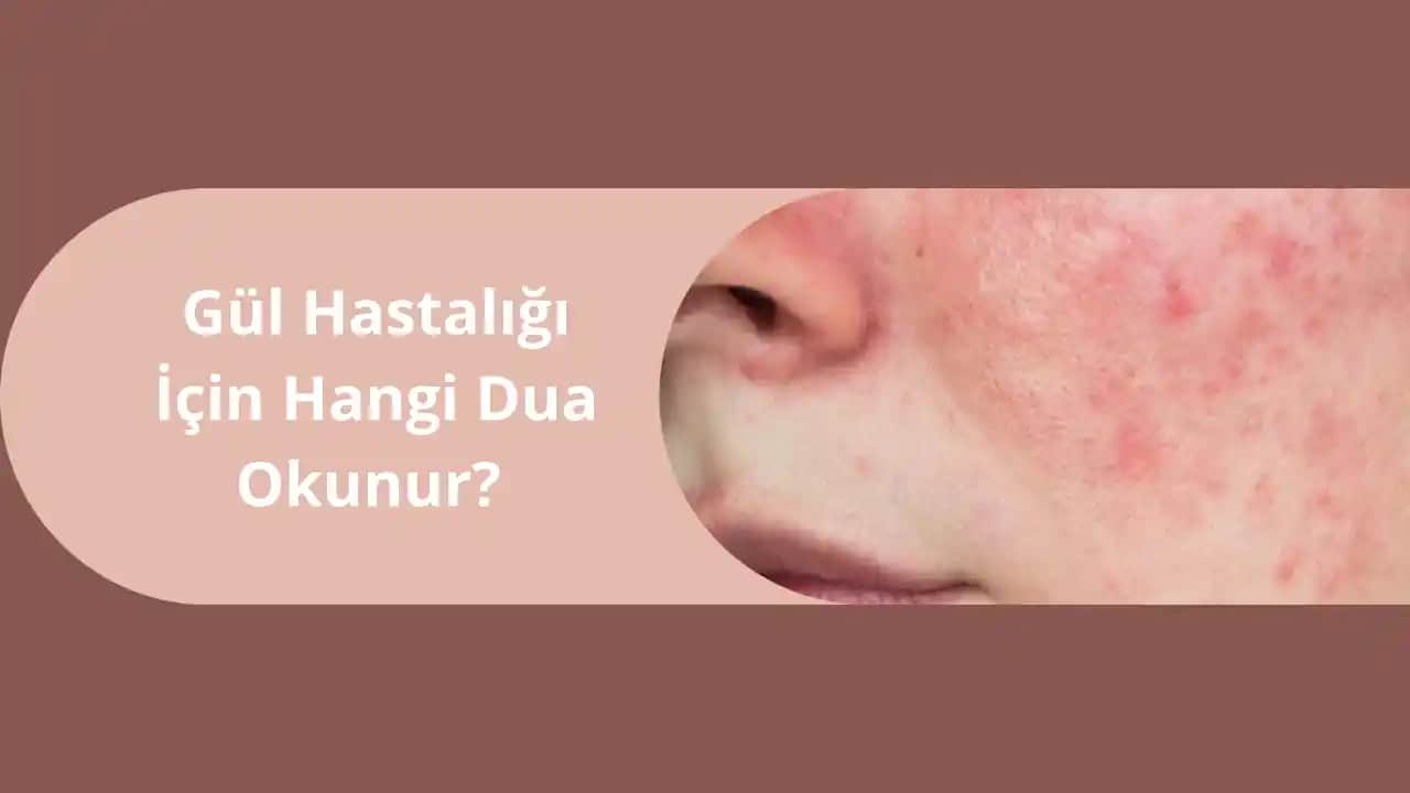 Burunda Gül Hastalığı: Belirtileri, Estetik Çözüm Yöntemleri ve Tedavi Yaklaşımları