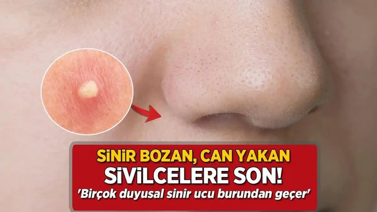 Burunda Sivilce Çıkma Nedenleri ve Korunma Yöntemleri İle Cilt Sağlığını Koruma
