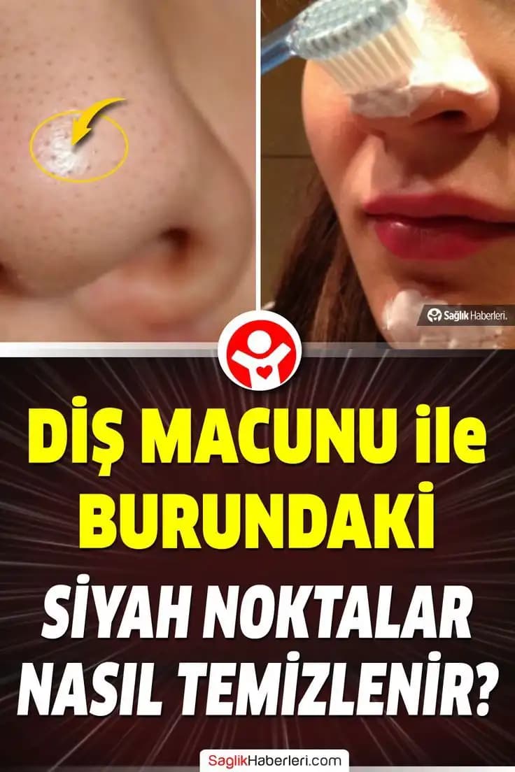 Burundaki Yağlar Nasıl Temizlenir ve Sağlıklı Cilt İçin En Etkili Yöntemler