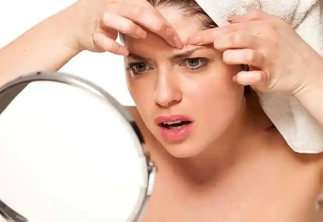 Çıban İzleri Nasıl Geçer: Doğal ve Medikal Yöntemlerle Cilt İyileştirme Rehberi