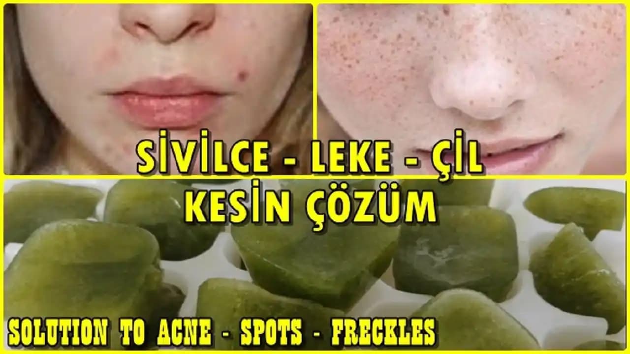 Çillere Karşı Etkili ve Kalıcı Çözüm Yöntemleri Cilt Sağlığını Koruma Rehberi