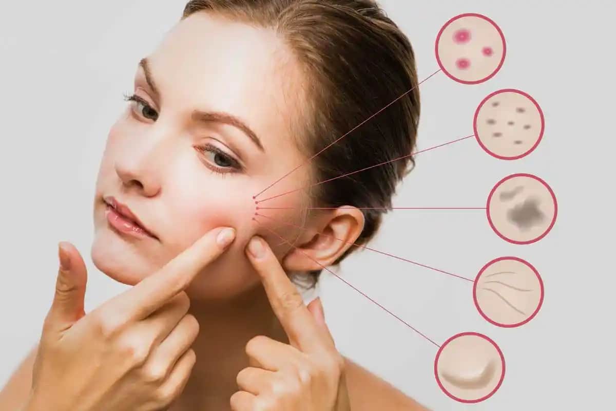 Cilt Sağlığını Koruma ve Güzelleştirme Yöntemleri Modern Yaklaşımlar ve Doğal Çözümler