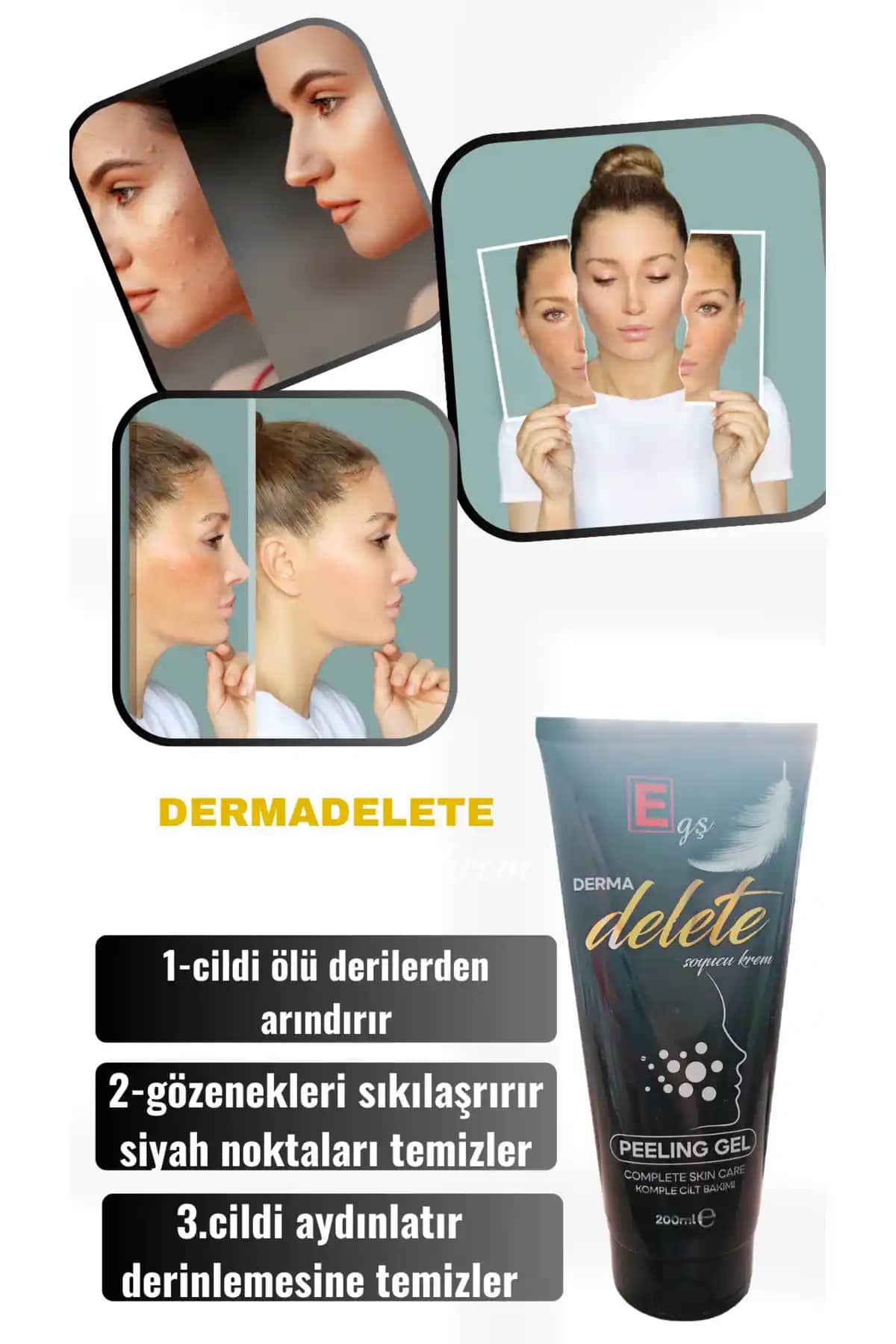 Cilt Soyucu Asitler ve Kimyasal Peeling ile Cilt Yenileme Yöntemleri