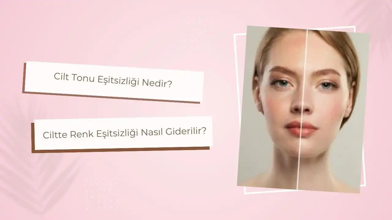 Cilt Tonu Eşitsizliği Nedir, Nedenleri ve Doğal Çözüm Yöntemleri