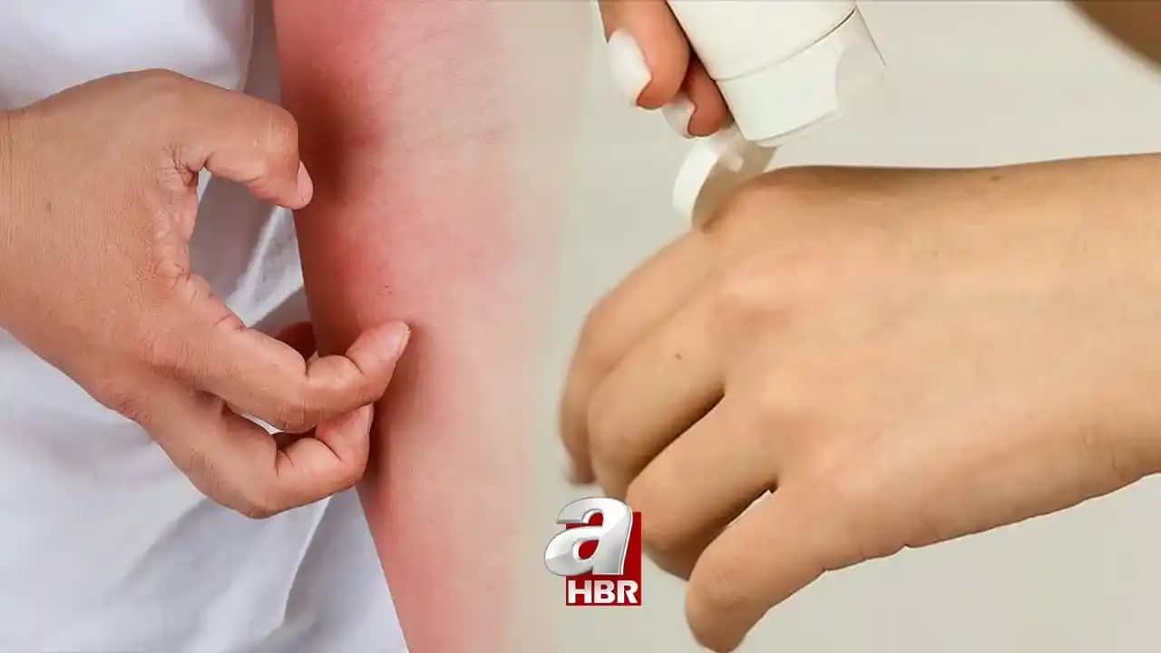 Ciltte Geçmeyen Kızarıklıkların Nedenleri ve Etkili Tedavi Yöntemleri