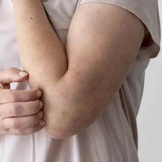 Ciltte Kaşıntı ve Kırmızı Yaralar: Kozmetik Bakımda Dikkat Edilmesi Gerekenler