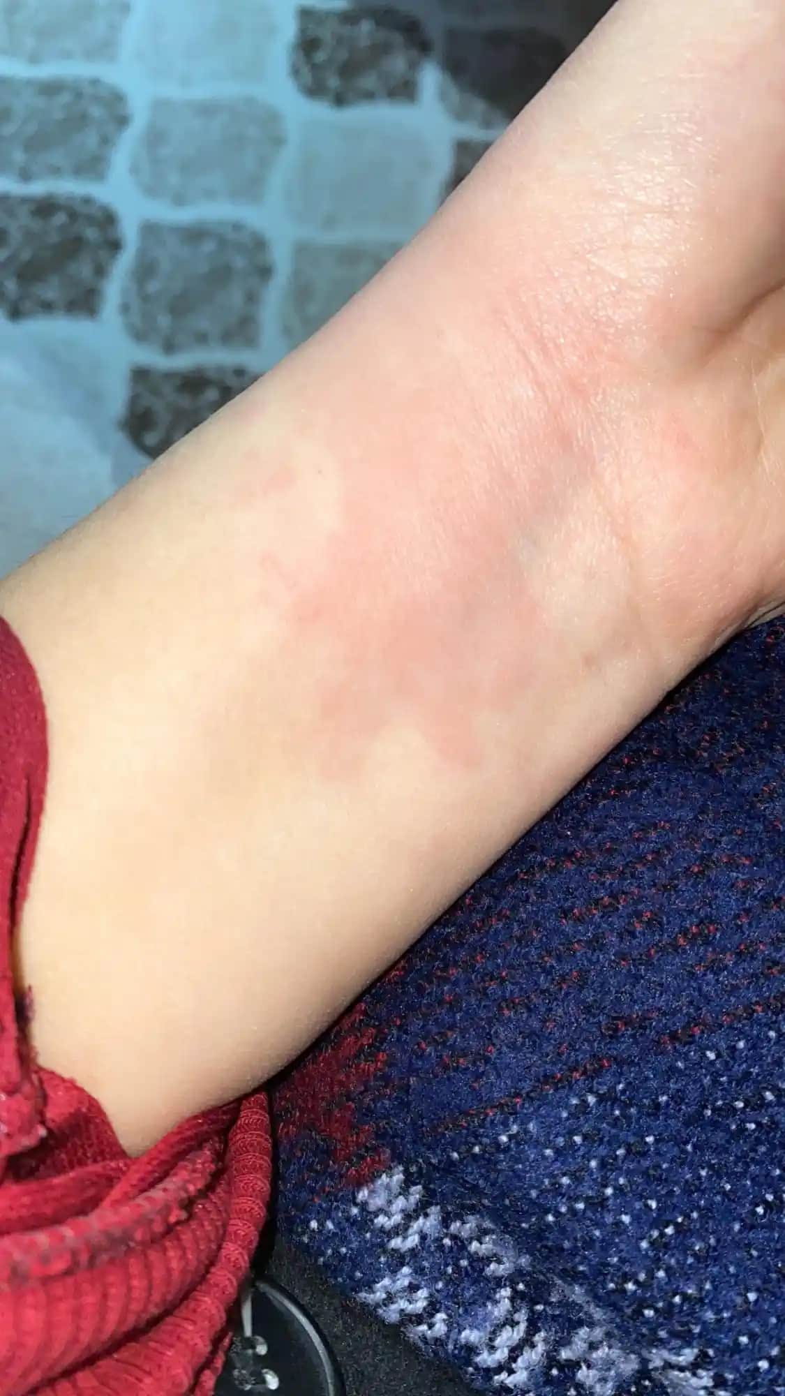 Ciltte Kaşıntı ve Yara Problemlerine Karşı Etkili Çözüm Yöntemleri ve Koruyucu Önlemler