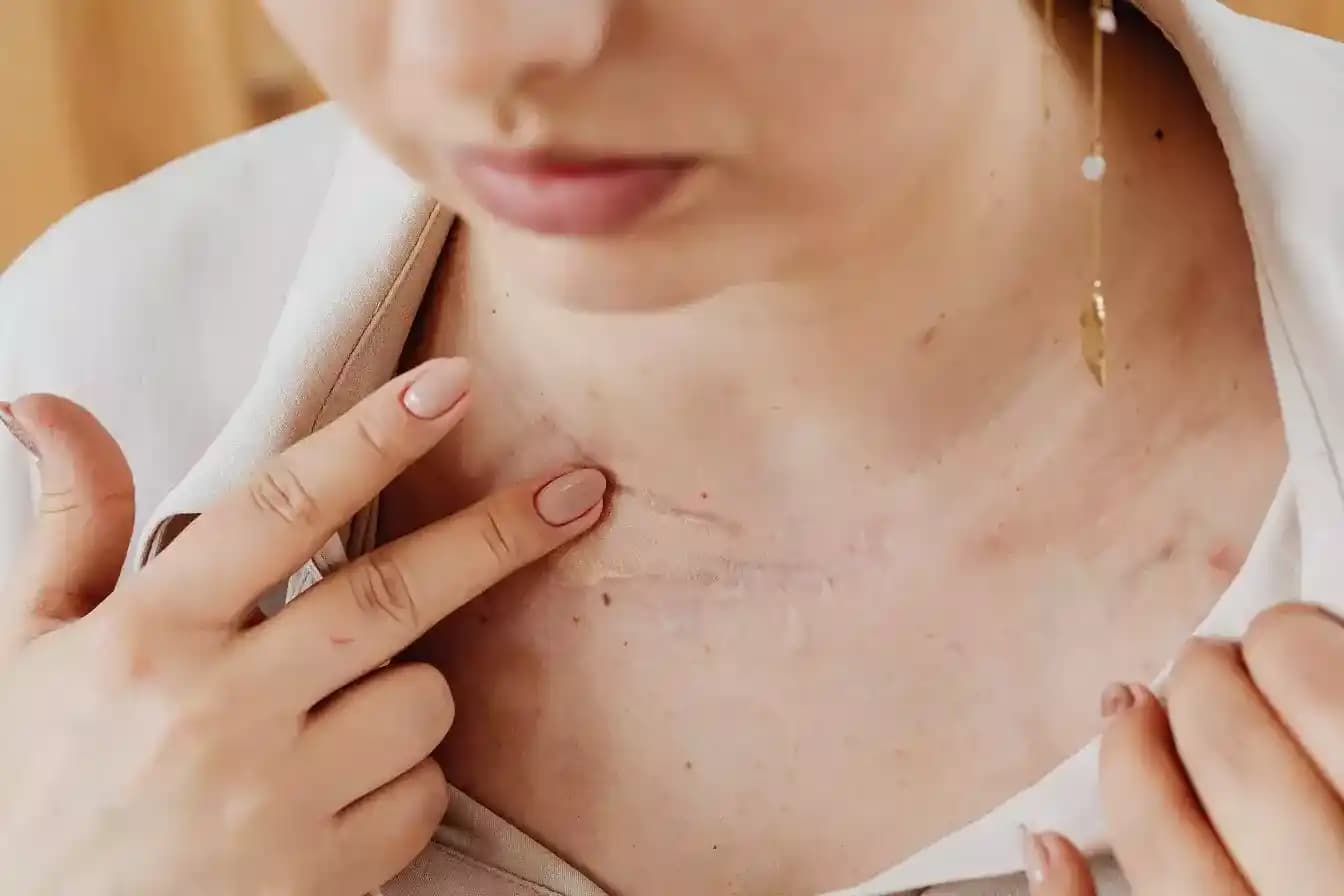 Ciltte Yara Oluşumu ve Kozmetik Ürünlerle Etkili Bakım Yöntemleri