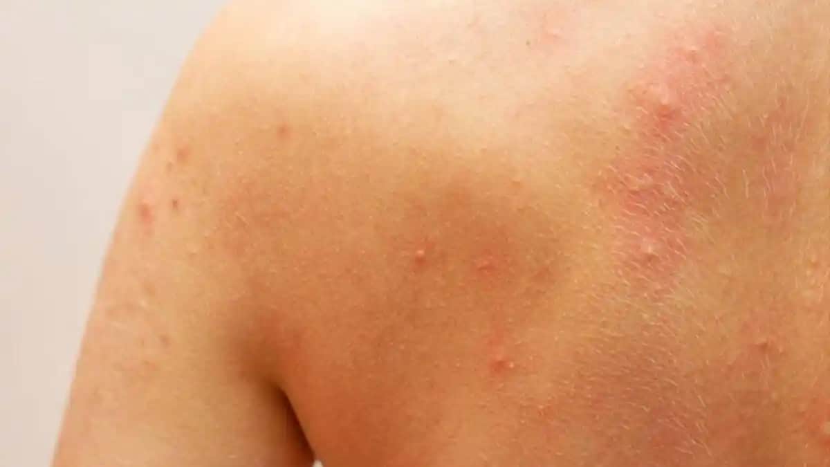 Ciltte Yaralar ve Kaşıntı: Doğru Bakım ve Kozmetik Kullanımıyla Sağlıklı Cilt