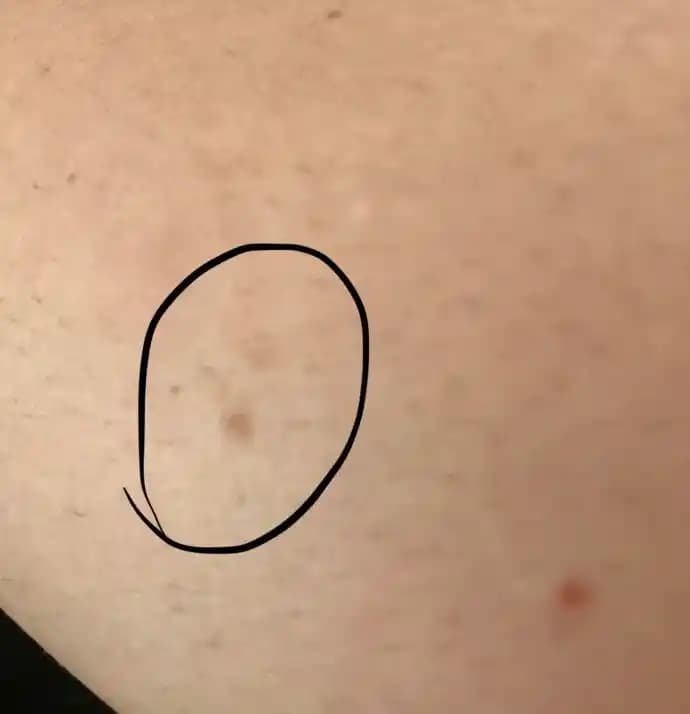 Ciltteki Lekelerin Nedenleri ve Etkili Çözüm Yolları Hakkında Kapsamlı Rehber