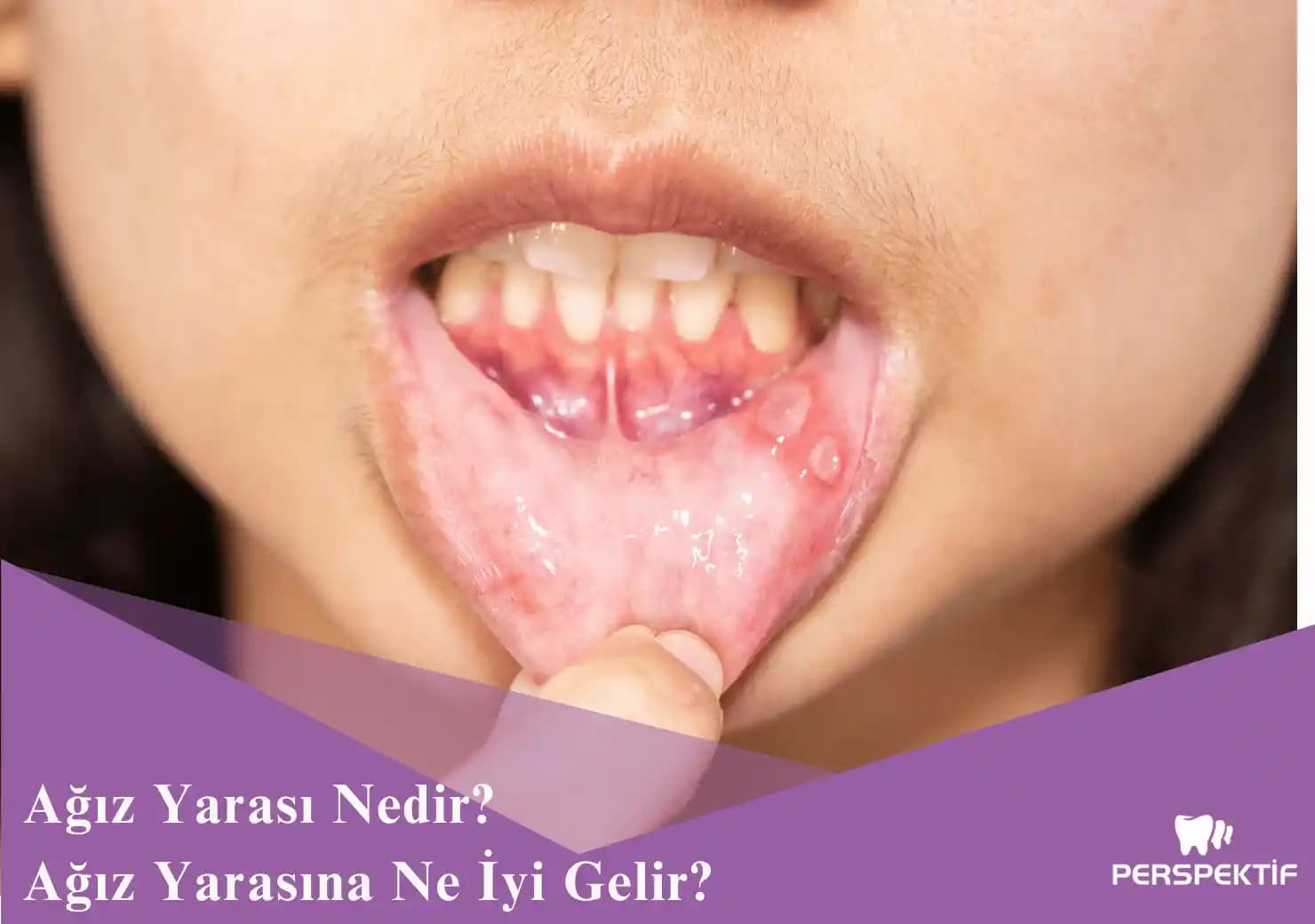 Çizik Yarasına Etkili Doğal ve Profesyonel Tedavi Yöntemleri