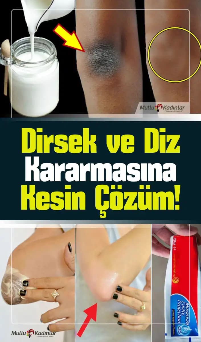 Deniz Kararması Nasıl Geçer Cilt Bakımında Etkili Yöntemler ve Korunma İpuçları