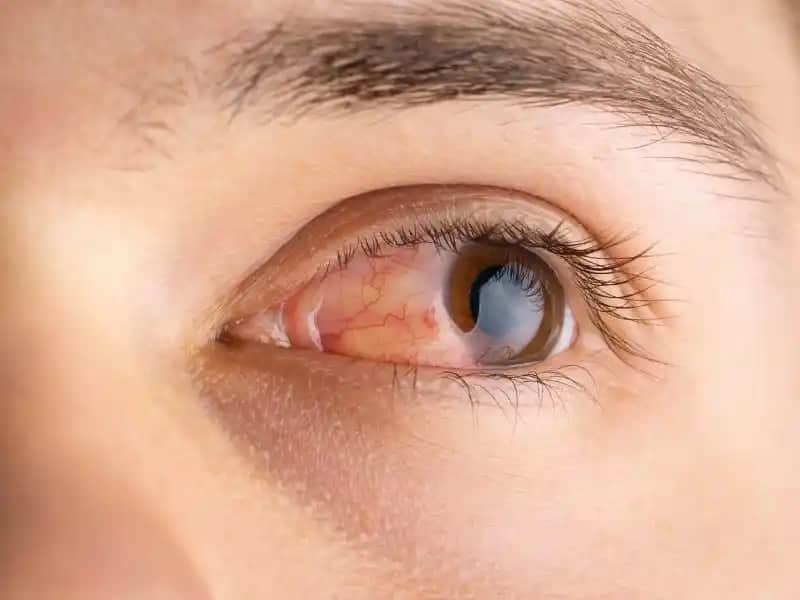 Deri Acıması ve Cilt Sağlığını Koruma Yöntemleri