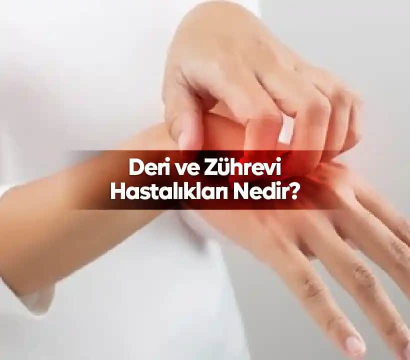 Deri Gribi Nedir Cilt Sağlığı ve Kozmetik Bağlantısı Hakkında Bilmeniz Gerekenler