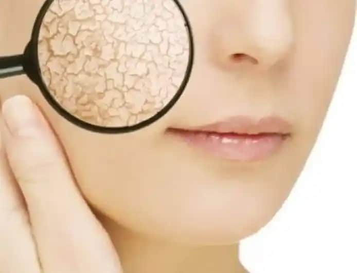 Deri Hassasiyetinin Nedenleri ve Korunma Yöntemleri Hakkında Kapsamlı Bilgi